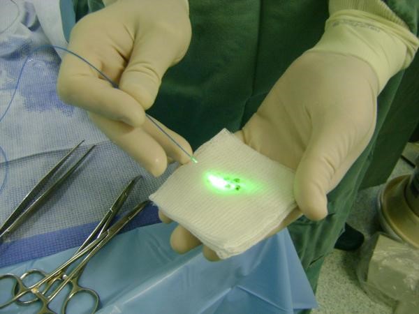 Tratamento a Laser de Cálculo Renal